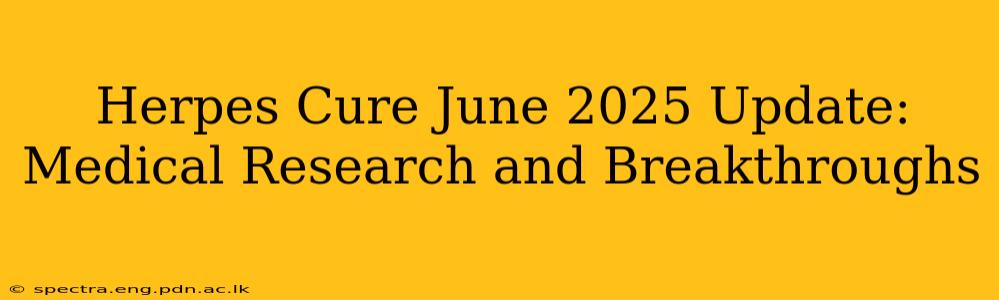 Herpes Cure June 2025 Update: Medical Research and Breakthroughs